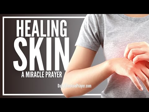 Prayer For Skin Healing | Acne, Allergy, Pimples, Eczema, Disease, All Problems Video