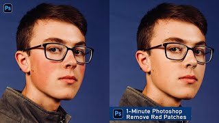 1 Minute Photoshop | Remove Red Patches from Skin in Photoshop
