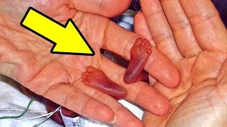 5 НЕВЕРОЯТНЫХ случаев рождения детей