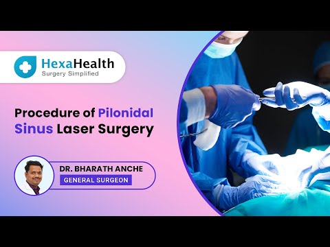 How is Laser Pilonidal Sinus Surgery done?|| HexaHealth Expert