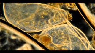 Austra- You Changed My Life