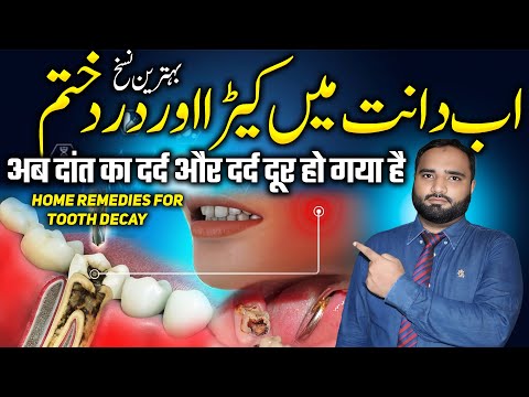 Ab Dant Mein kida aur Dard khatm | Top Home Remedies For Tooth Cavity | cavities in teeth