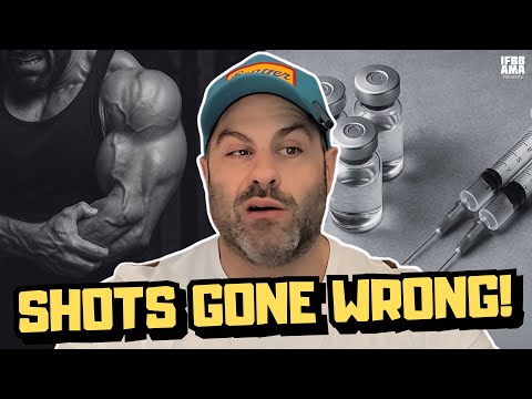 When Injections Go Wrong: Brutal Lessons from 20 Years of Gear Use