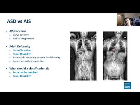 Virginie Lafage -  Adult Spinal Deformity