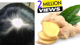 Ginger Juice to Cure Baldness & Regrow New Hair | Sushmita