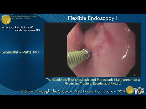 The Combined Bronchoscopic and Endoscopic Management of a Recurrent Tracheo-Esophageal Fistula