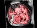 Bile - Demons
