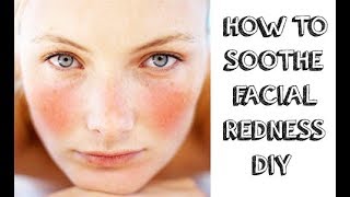 How to Soothe Face redness? The Best Home Remedies for Red and Irritated Skin.