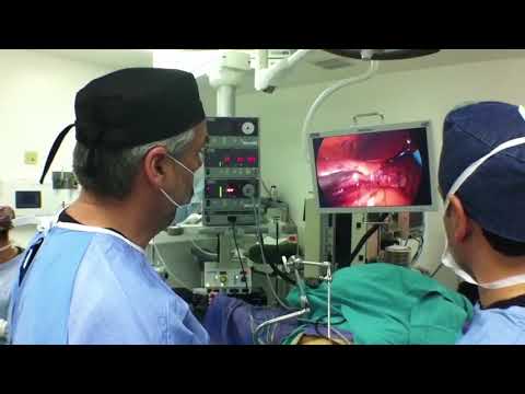 Master Bariatric Surgeon Conducts a Gastric Band Revision to a Gastric Sleeve