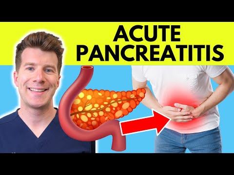 Doctor explains Acute Pancreatitis | Causes, Symptoms, Treatment