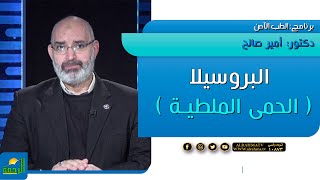 البروسيلا ( الحمى الملطية ) برنامج  الطب الآمن | دكتور أمير صالح