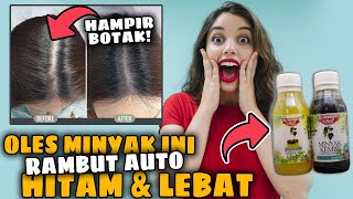 Download lagu LUAR BIASA! 5 Manfaat Minyak Kemiri Al Khodry Penumbuh Rambut Paling Ampuh Atasi Kebotakan mp3