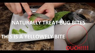 HOW TO NATURALLY TREAT PAINFUL BUG BITES | YELLOW FLY BITES
