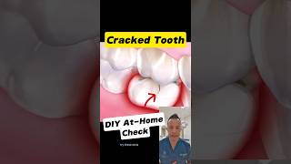 Is Your Tooth Cracked? 3 Quick Home Tests You Can Try #dentallan #dentist #shorts