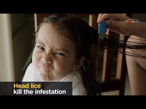 Head Lice, facts and myths.