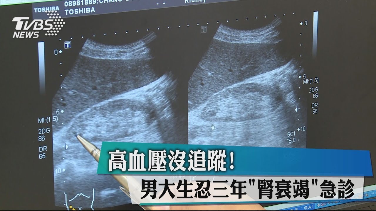 高血壓沒追蹤! 男大生忍3年「腎衰竭」急診