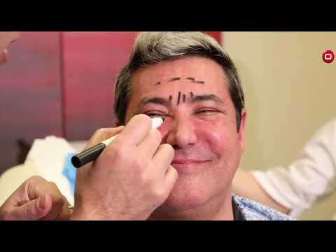 شاهد بالفيديو.. عملية إزالة التجاعيد في بشرة الرجل - الجمال نادر وصعب - الحلقة ١٣