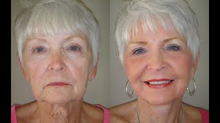 Radiant Skin Reborn: Laser Resurfacing for Naturally Beautiful Results!