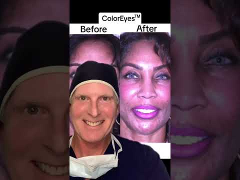 Immediately Changes Eye Color!