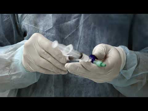 Foam Sclerotherapy Preparation for Varicose Veins Treatment