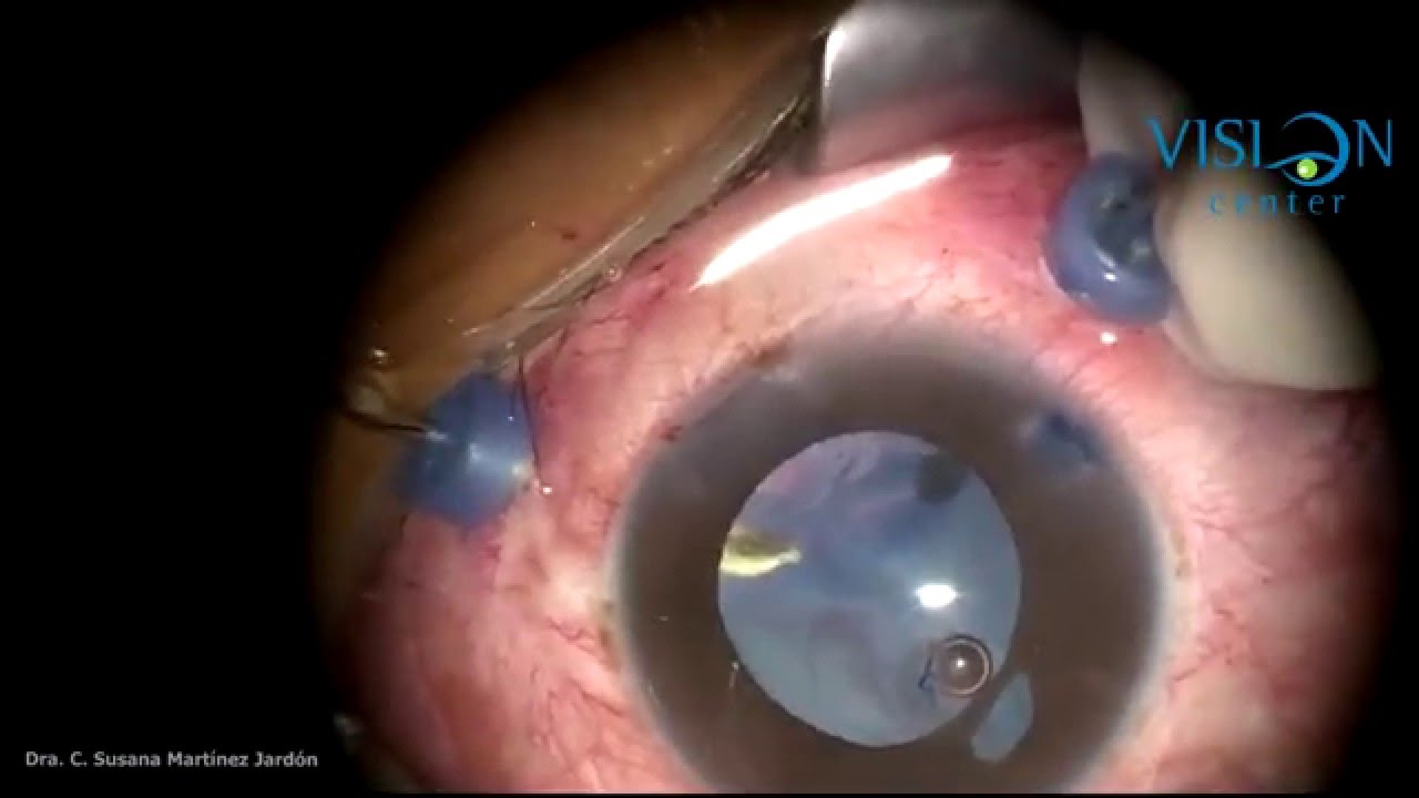 C. Susana Martinez Jardon-21