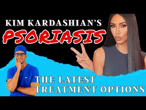Kim Kardashian's Psoriasis Treatment Options