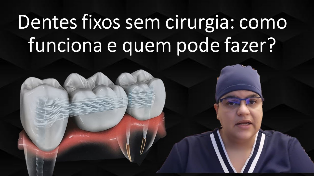 Como ter dentes fixos sem implantes em 1 dia | Dra Bianca Rosa | Clínica Bianca Rosa