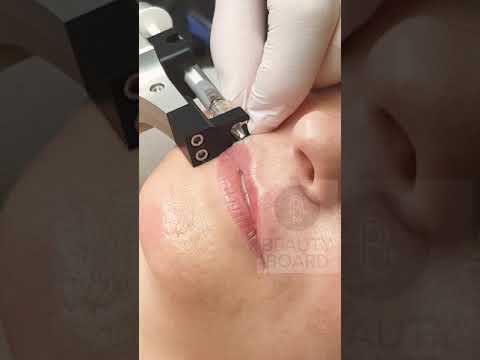 Doktor lecture tungkol sa pagkawala ng timbang Matapos pagbaba ng timbang facial balat sagged kung ano ang gagawin sa bahay