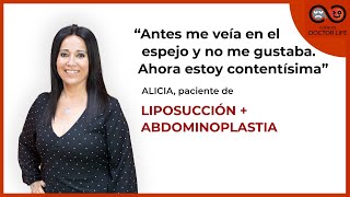 Paciente de Abdominoplastia con Liposucción - CLÍNICAS DOCTOR LIFE - Clínicas Doctor Life Barcelona