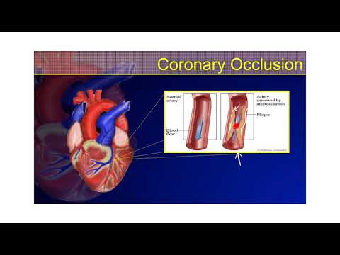 The 12-Lead ECG Course - STEMI Part 1