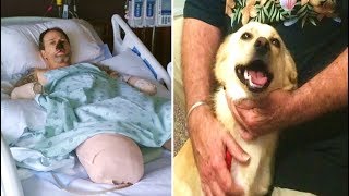 Man Loses Limbs After Dog Licks Him And This Doctor Explains Why You Should Be Careful