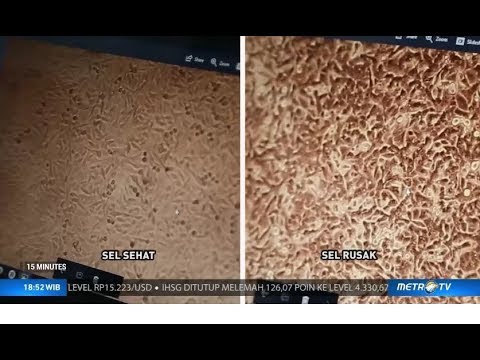 a hpv kockázata az emberekre mint például a nemi szemölcsök kezelése nőknél