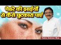चेहरे की झाईयों से कैसे छुटकारा पाएं Hak