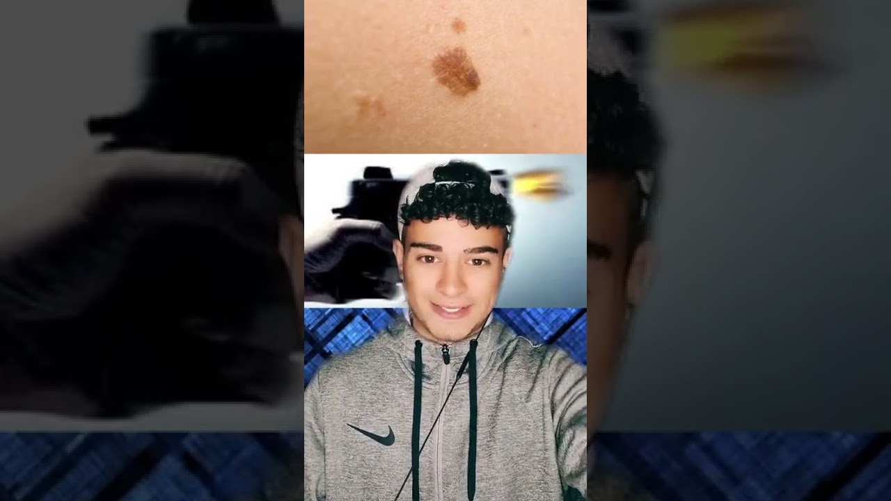 QUELLO CHE LA TUA VOGLIA DI NASCITA DICE SULLA TUA VITA PASSATA