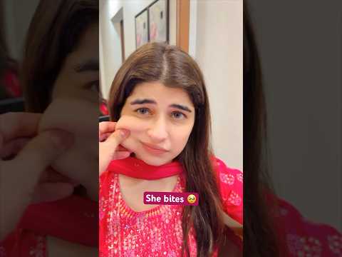 She has teeth 🦷🥹 #ashortaday #comedy #funnyshorts #sajidshahid #funny #funnyvideos #couple