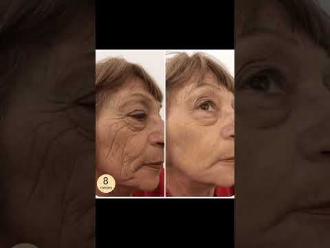 COMO REMOVER RUGAS DO ROSTO E FLACIDEZ. #shorts #rugas