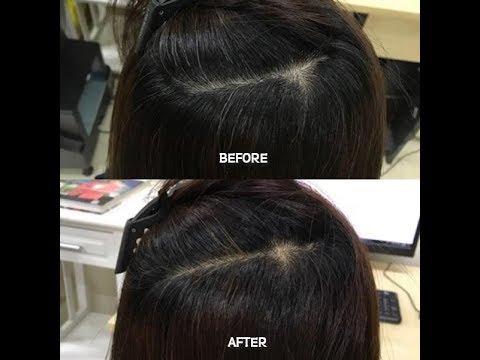 download lagu mp3 mp4 Origin Herbal, download lagu Origin Herbal gratis, unduh video klip Origin Herbal