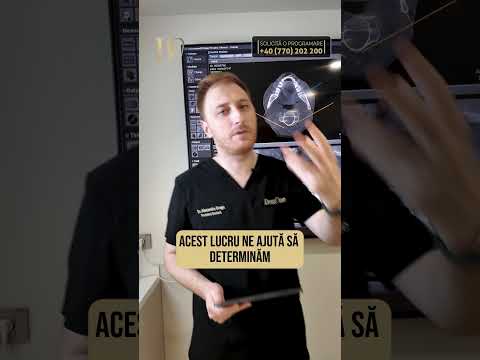 Ce este computerul tomograf dentar și de ce este important?