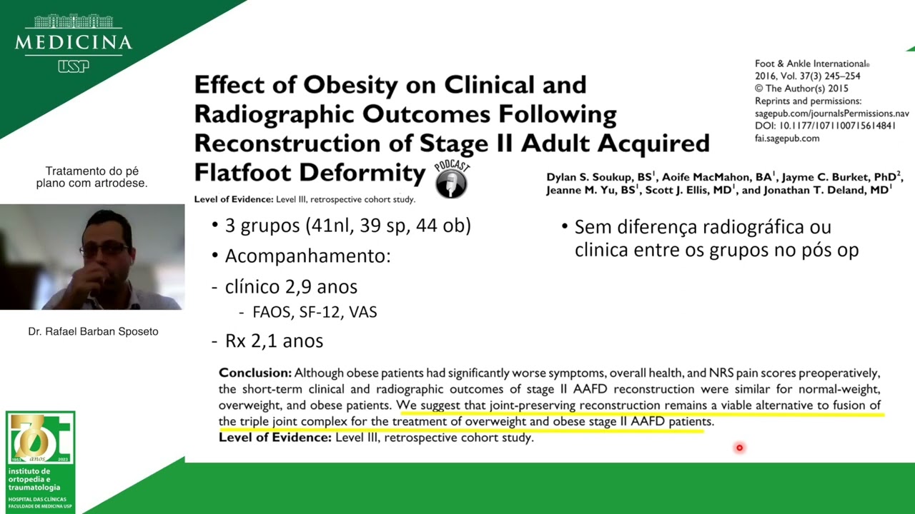Tratamento do pé plano com artrodese - Dr  Rafael Barban Sposeto