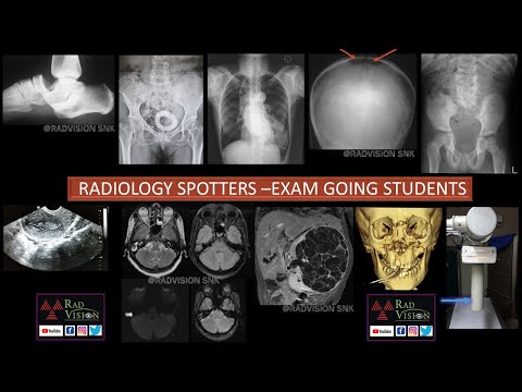 EXAM GOING STUDENTS RADIOLOGY SPOTTERS  SET III