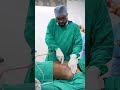 Gynecomastia Surgery Cost Shorts Shortsvideo Dezireclinicindia