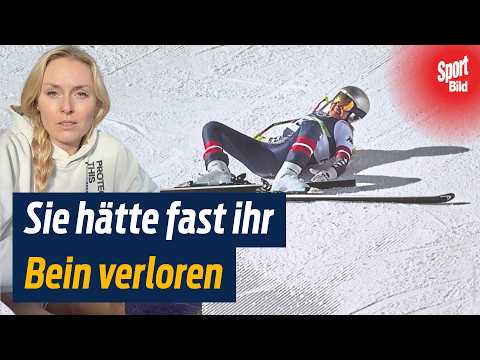 Ski-Star Lindsey Vonn spricht über ihren Unfall und die Operationen