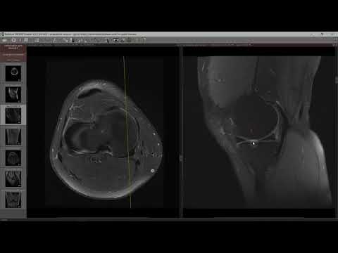 cercetarea tratamentului comun