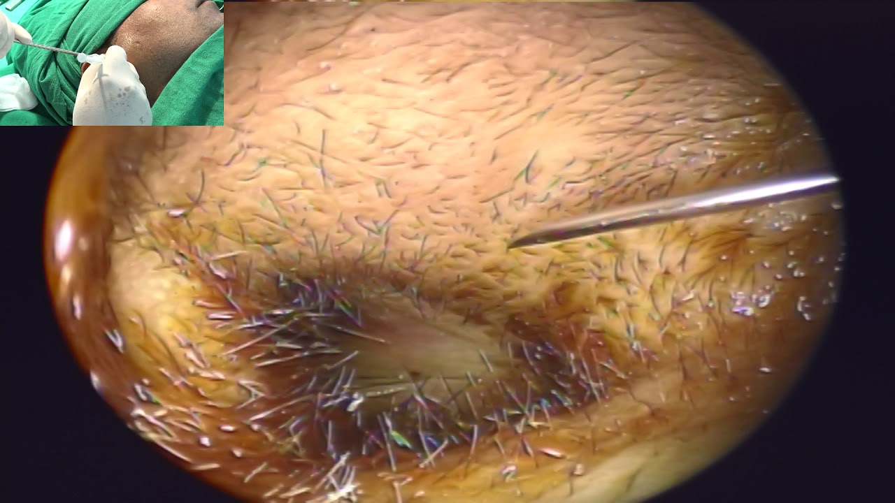 ENT Summit Society, Lucknow