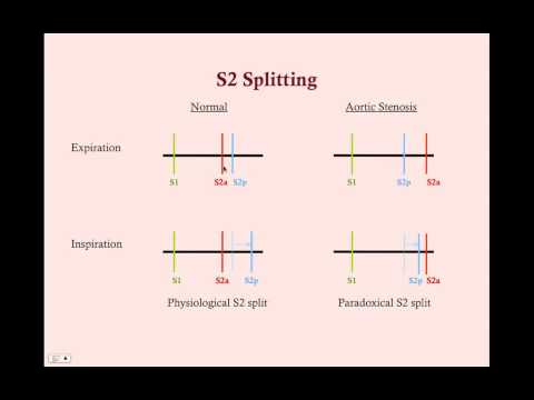 Valvular Heart Disease - CRASH! Medical Review Series