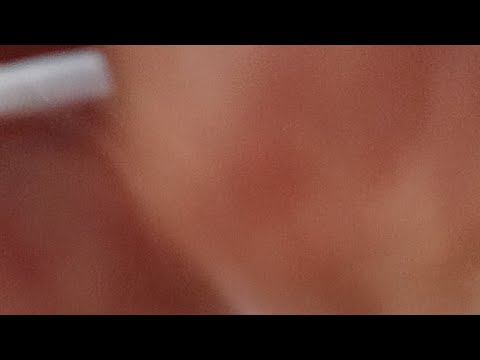 P16 B-lohko O2 Vs Welhot