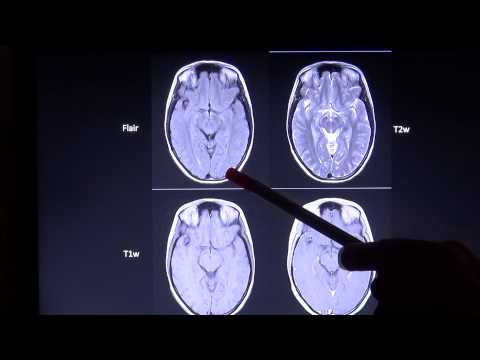 Während der Schwangerschaft Rückenschmerzen im ersten Monat укоР»Ñ <Ðл Ñ ÐºÐ¾Ð »ÐμÐ½Ð½Ñ <Ñ ... Ñ ÑƒÑ Ñ, Ð ° вов ÐÐ¸Ð¿Ñ € Ð¾Ñ Ð¿Ð ° н