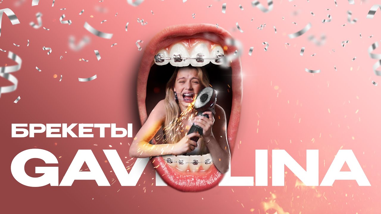 Gavrilina — Брекеты