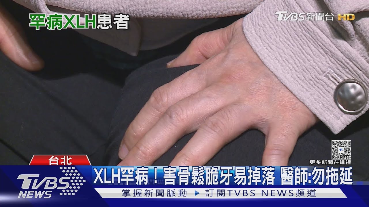 骨頭缺磷像空心磚!罹「這疾病」缺牙也是常見症狀 醫籲速就醫檢查