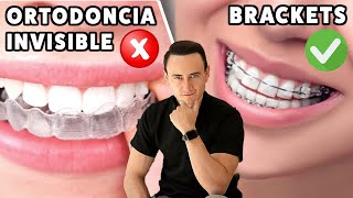La ortodoncia invisible NO ES PARA TODOS | Brackets vs Invisalign